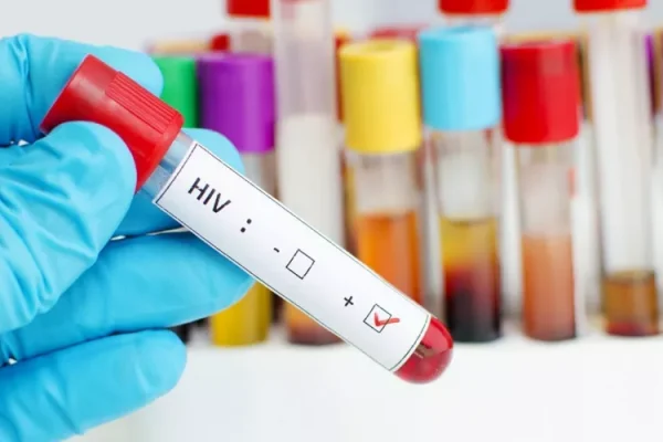 Your Guide to Choosing a Reliable STD Testing Clinic Near Me